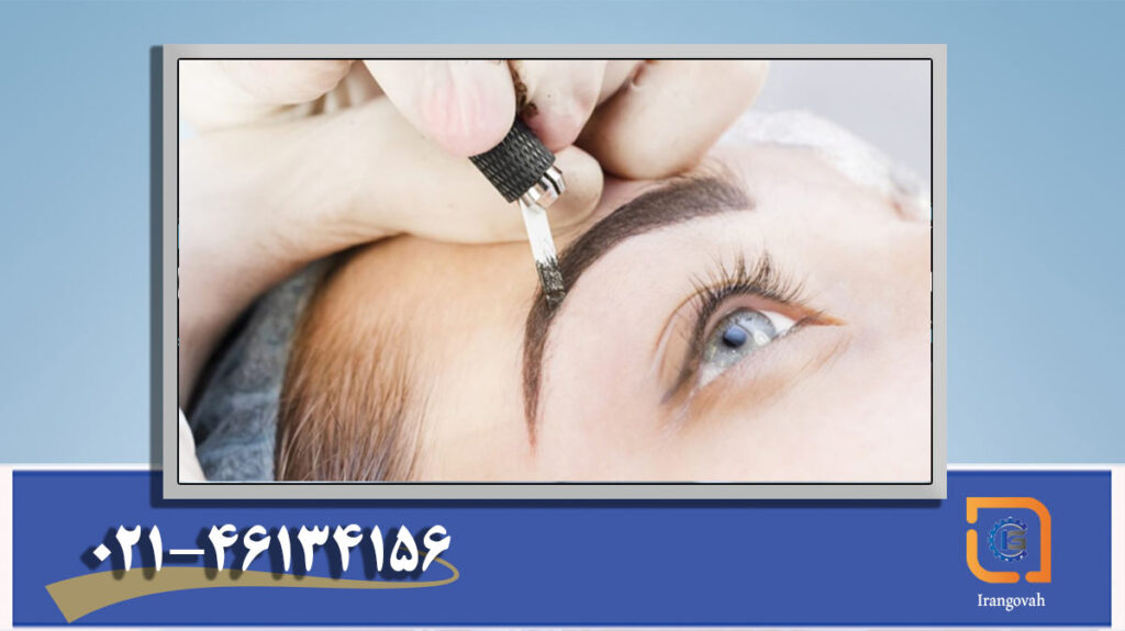 مدرک میکروبلیدینگ (فیبروز ابرو)